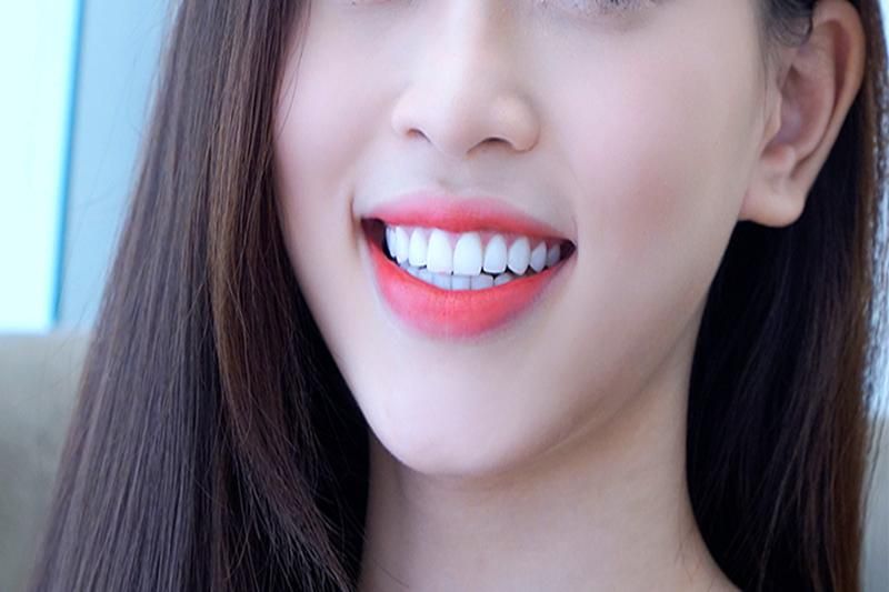 plus de confiance grâce à des dents saines. Source : xaydungso.vn