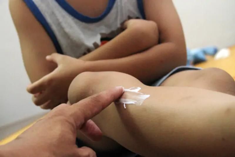 répulsif anti-moustiques - les choses neccesaires pour preparer un voyage au vietnam